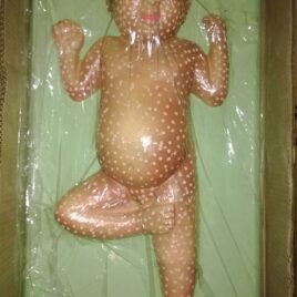 Disease Small Pox